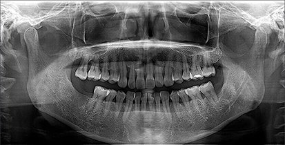 Orthopantomogram (OPG) dental X-ray equipment at Sun Imaging & Diagnostics
